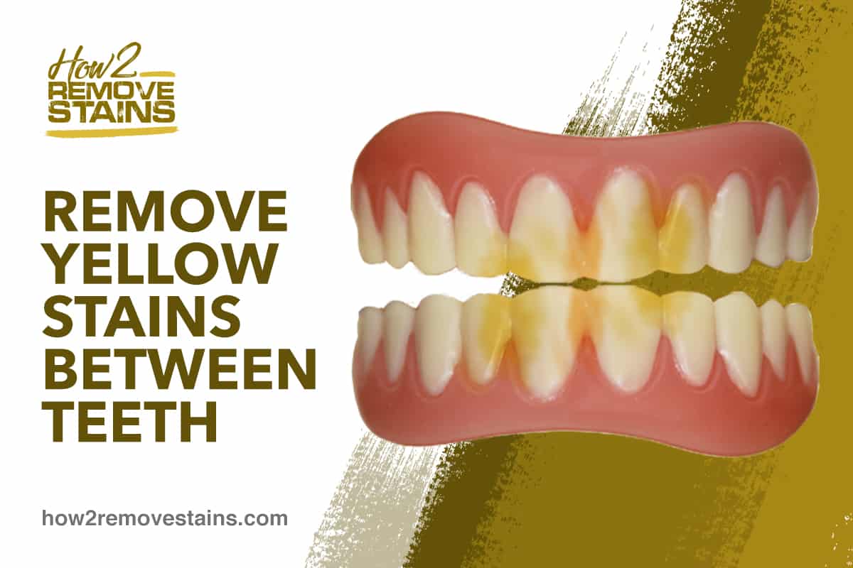 Hur man tar bort gula fläckar mellan tänderna