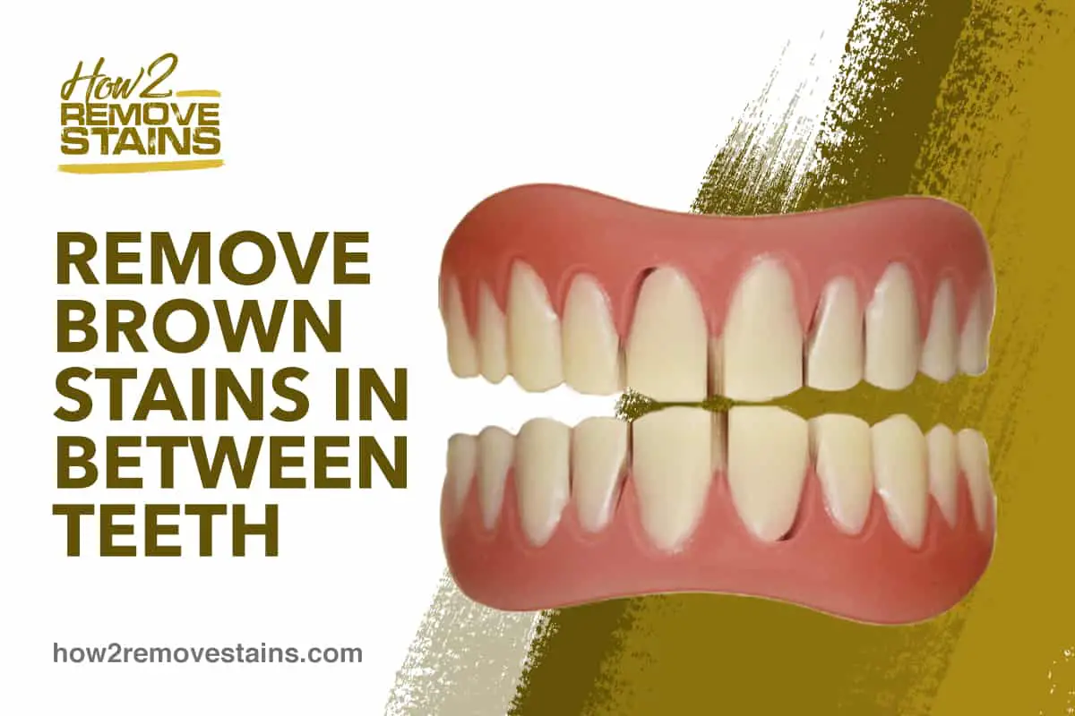 Hur man tar bort bruna fläckar mellan tänderna